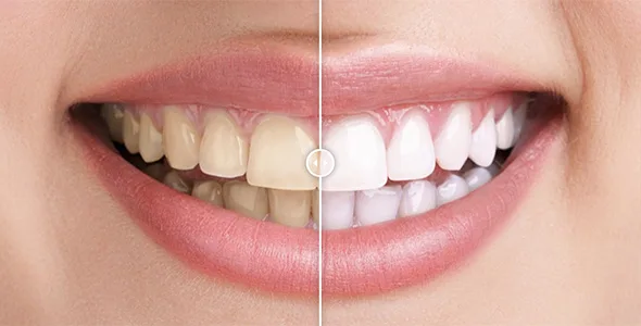 before after images comparison wordpress plugin 1
